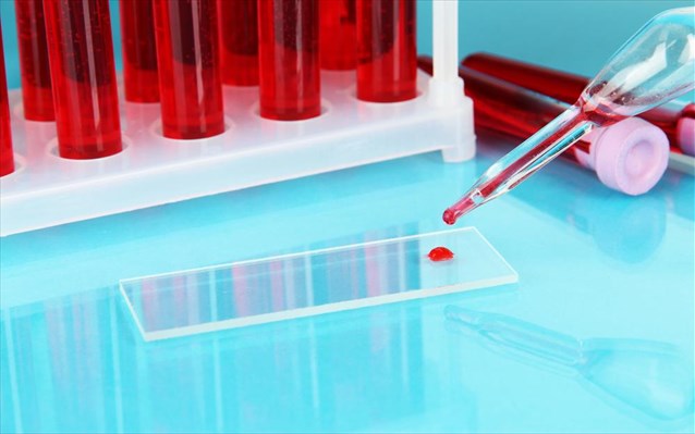 “Φαρμακείο” οι εξετάσεις αίματος στην Ελλάδα