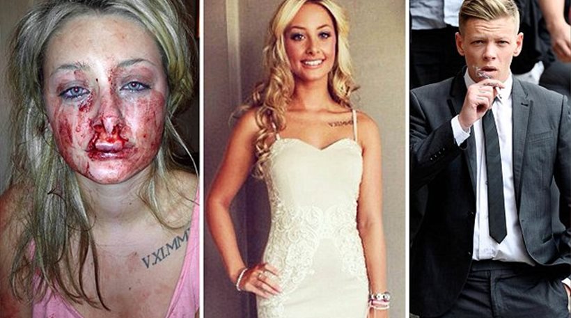 ΦΩΤΟ-Από τη ζήλια του την παραμόρφωσε με ένα… φιλί