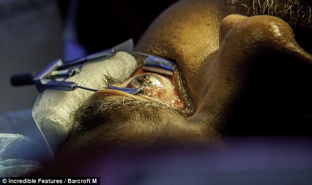 ΦΩΤΟ-Τατουάζ μέσα στο μάτι