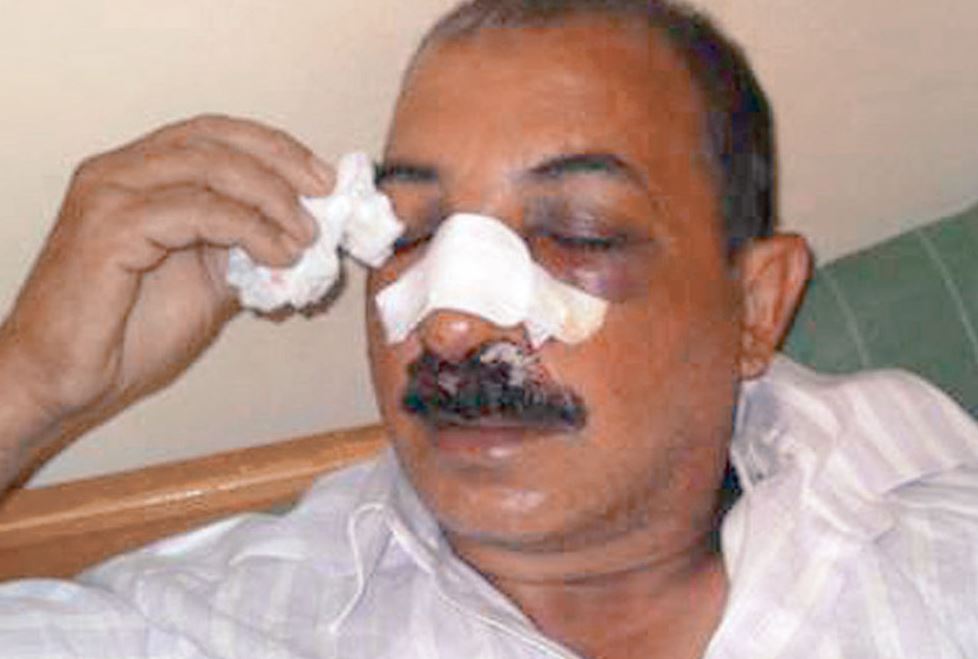 Η μαρτυρία του 50χρονου Πακιστανού που δέχθηκε επίθεση στην Κοκκινιά