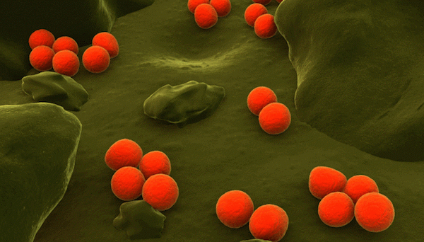 Τα συμπτώματα της γονόρροιας-Πόσο επικίνδυνη είναι;