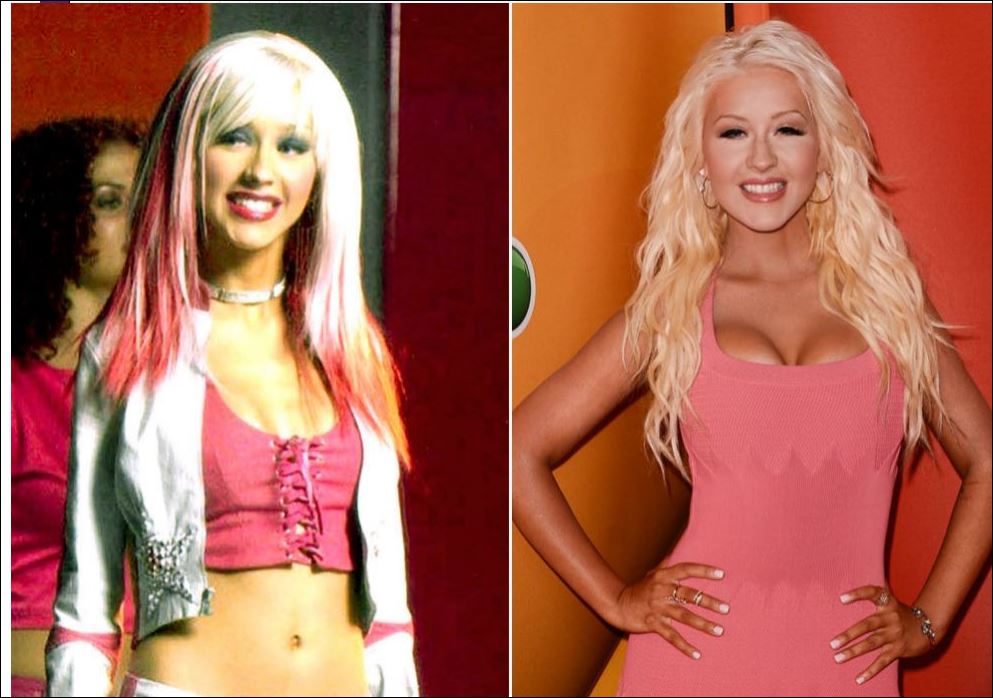 ΦΩΤΟ-Δείτε τις πριν και μετά την πλαστική