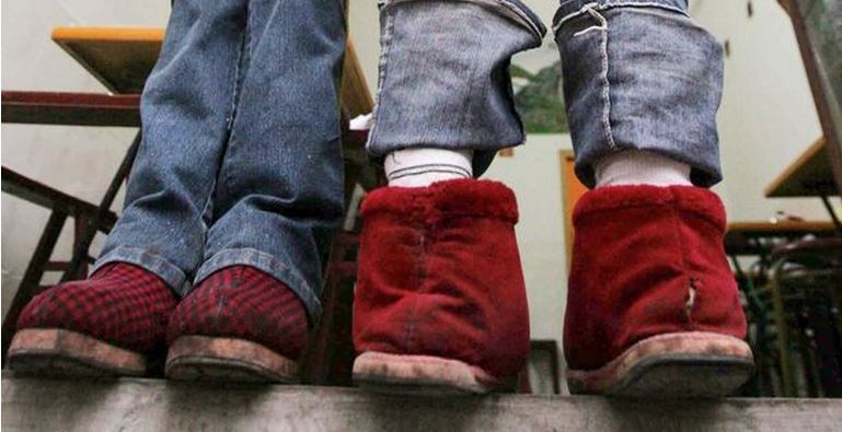 ΦΩΤΟ-Η γυναίκα που γεννήθηκε με τα πόδια… ανάποδα