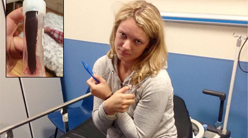 Ζούσε με μία βδέλλα στη μύτη της