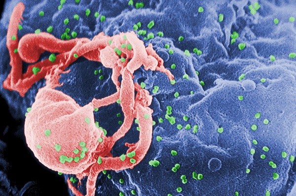 Οι 3 στους 10 Αμερικανοί οροθετικοί έχουν υπό έλεγχο τον ιό HIV