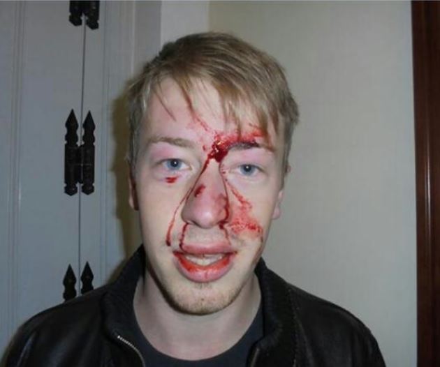 ΦΩΤΟ-Γερμανός φοιτητής καταγγέλλει ότι δέχθηκε επίθεση από τα ΜΑΤ