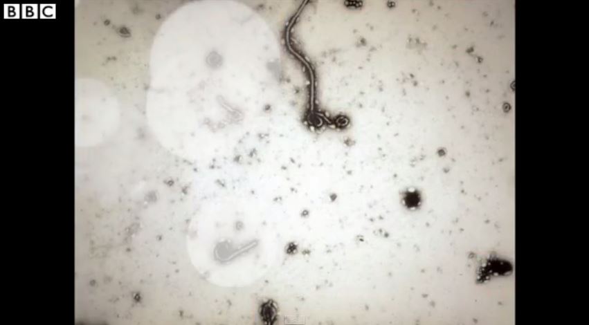 ΒΙΝΤΕΟ-Πως ανακαλύφθηκε ο Έμπολα