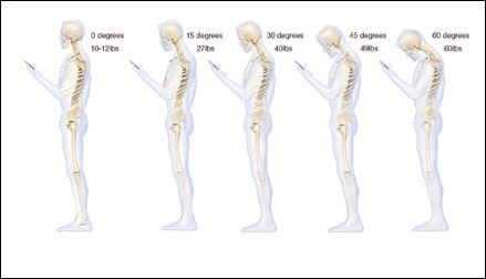 Το κινητό καταπονεί τη σπονδυλική στήλη