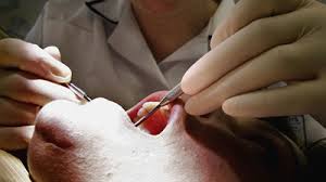 Θα απελάσουν τον “οδοντίατρο του τρόμου”