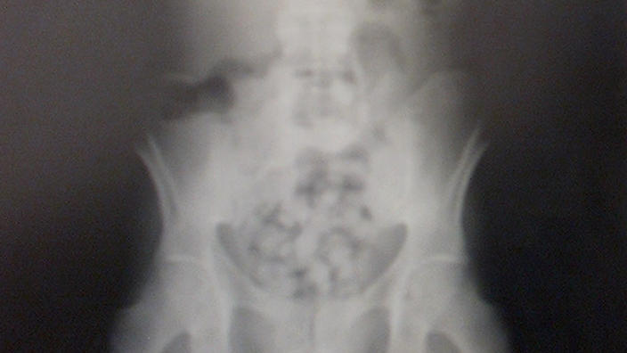 Έβαλε την κόρη του να καταπιεί μισό κιλό κοκαΐνη