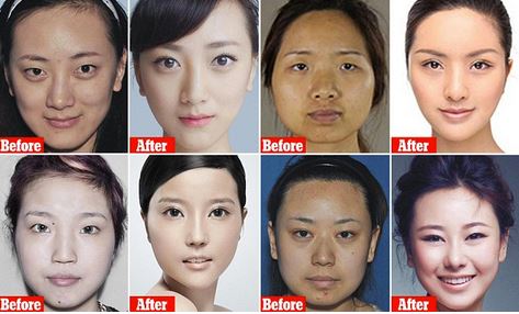 ΦΩΤΟ-Γυρίζουν αγνώριστες μετά από πλαστικές και “κολλάνε” στο αεροδρόμιο