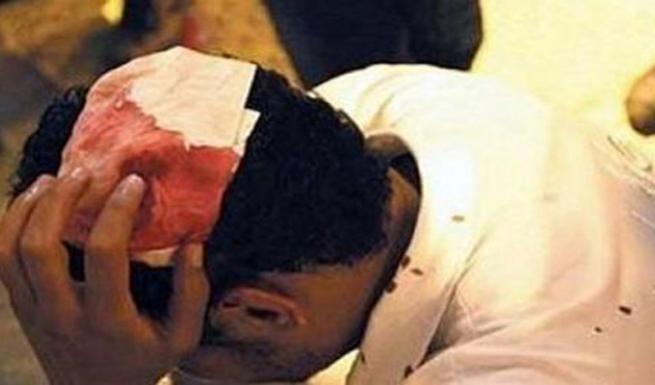 Ξύλο μεταξύ Πακιστανών στον Πύργο