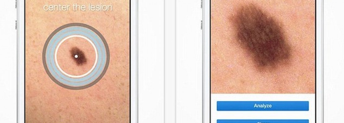 Εφαρμογή “Δερματολόγος”-Παρακολουθεί αλλαγές στο δέρμα και τους σπίλους