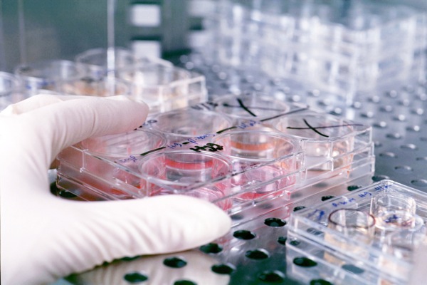 Θερίζει η πανώλη στη Μαδαγασκάρη-40 νεκροί