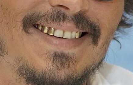 ΦΩΤΟ-Διάσημοι με χαλασμένα δόντια