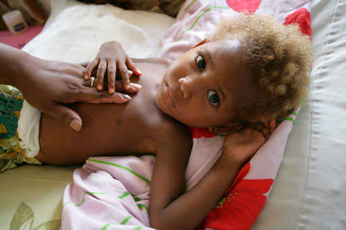 Μειώνονται οι θάνατοι από πνευμονία