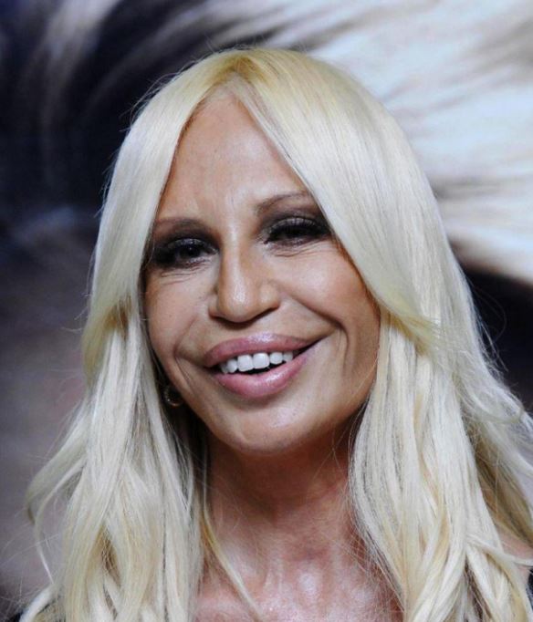 Τα διάσημα θύματα των πλαστικών – ΦΩΤΟ