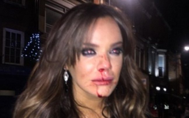 Η “καριέρα” της στην tv δεν την έσωσε από τον ξυλοδαρμό –ΦΩΤΟ