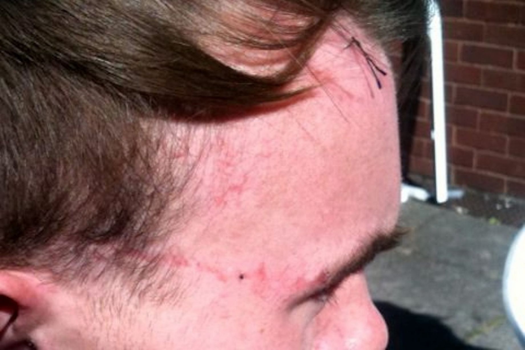 Μετά το κώμα νόμιζε πως είναι ο Μάθιου Μακόναχι