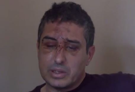 Απείλησαν κι άλλον αντιδήμαρχο στο Ηράκλειο