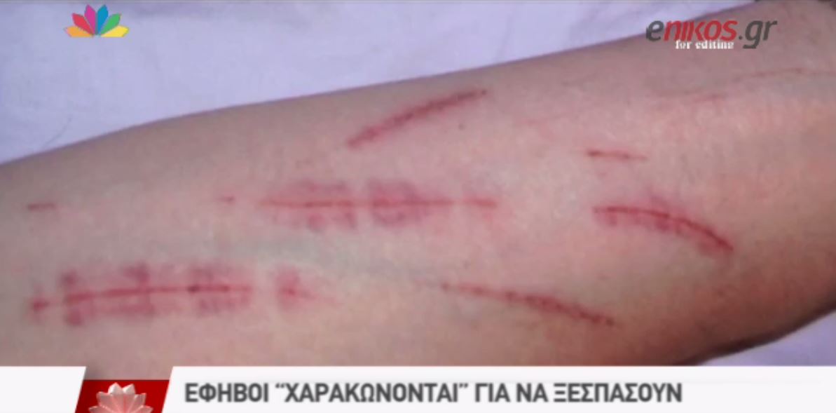 Έφηβοι “χαρακώνονται” για να ξεσπάσουν – ΒΙΝΤΕΟ