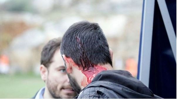 ΦΩΤΟ-Ξύλο στο γήπεδο-Στο νοσοκομείο φίλαθλος της Καλαμάτας