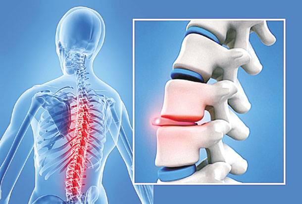 Έρευνα-Εμφύτευμα δίνει ελπίδες σε παράλυτους ανθρώπους