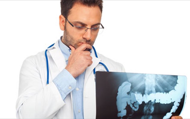 Καρκίνος του εντέρου: Συμπτώματα και αντιμετώπιση