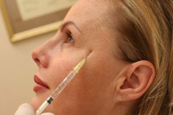 5 πράγματα που δεν ξέρετε για το μπότοξ