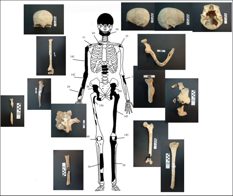 Πέντε οι σκελετοί που βρέθηκαν στην Αμφίπολη – ΦΩΤΟ