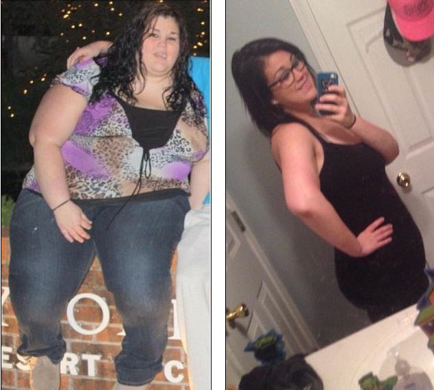 Τι συμβαίνει όταν χάνεις 95 κιλά; – ΒΙΝΤΕΟ – ΦΩΤΟ