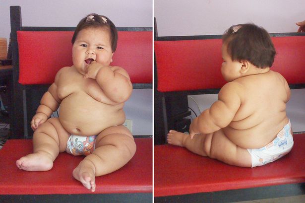 Το βρέφος που ζυγίζει όσο ένα παιδί 5 ετών – ΒΙΝΤΕΟ