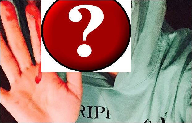 Η… ματωμένη selfie γνωστής τραγουδίστριας – ΦΩΤΟ