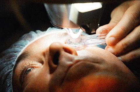 Διόρθωση μυωπίας για αυτούς που αθλούνται