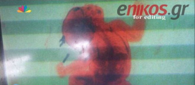 Σκάνερ έδειξε ότι στο σακίδιο ήταν κρυμμένο… ένα μωρό – ΒΙΝΤΕΟ