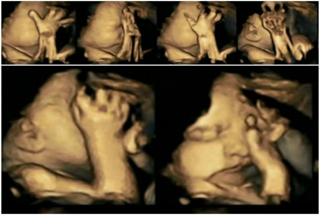 Υπερηχογράφημα δείχνει πως αντιδρά το έμβρυο στο κάπν��σμα