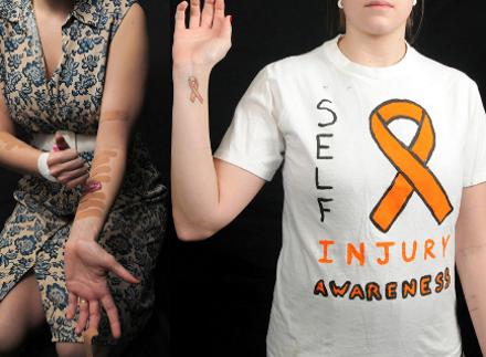 Παγκόσμια ημέρα κατά του αυτοβασανισμού