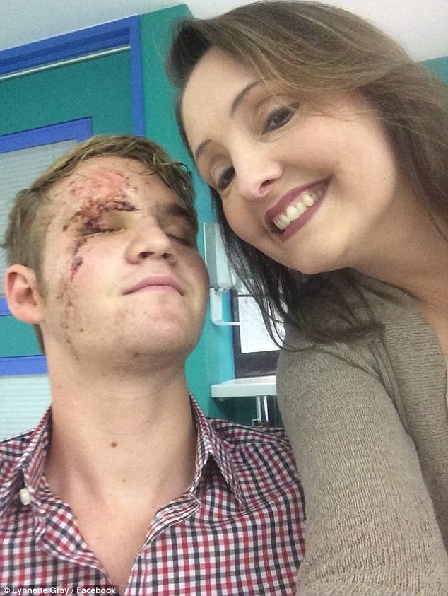 Support: The young actor's agent also visited him in hospital and apparently reassured him that he hadn't lost his good looks