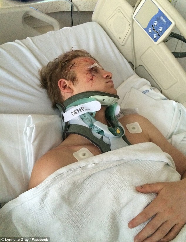 Almost blinded: The actor, 20, was reportedly lucky to keep his sight after the crash which left pieces of glass embedded in his face. His mom shared photos of what had happened to him on social media