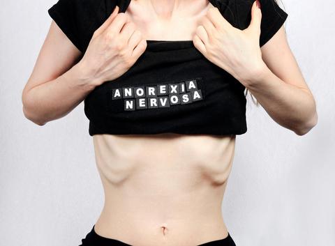 Η Γαλλία απαγορεύει από τις πασαρέλες τα υπερβολικά αδύνατα μοντέλα