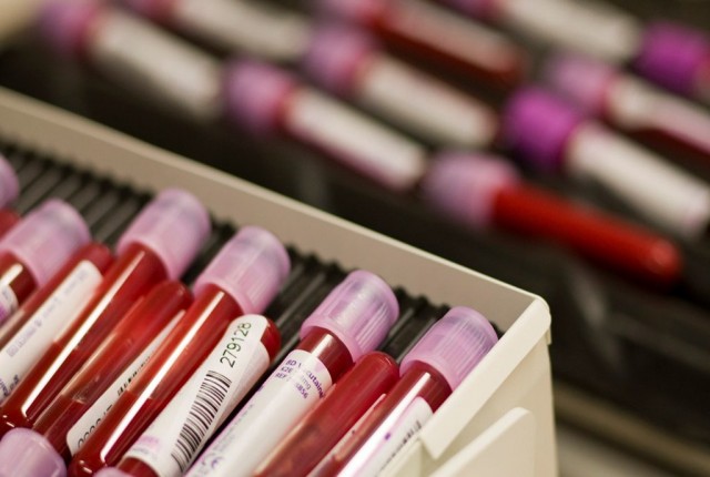 Ομάδα αίματος- Τι δείχνει για την υγεία μας