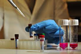 Νέο τεστ αίματος για το σύνδρομο Ντάουν