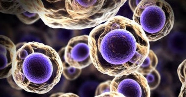 Βρέθηκε η πρωτεΐνη που ενισχύει την ανοσία απέναντι στον καρκίνο