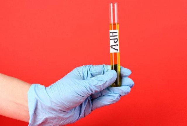 Κονδυλώματα: Τι πρέπει να προσέχεις