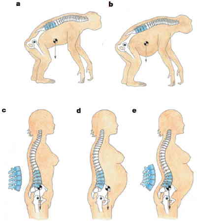Αν πονάς στη μέση μοιάζεις με… χιμπατζή