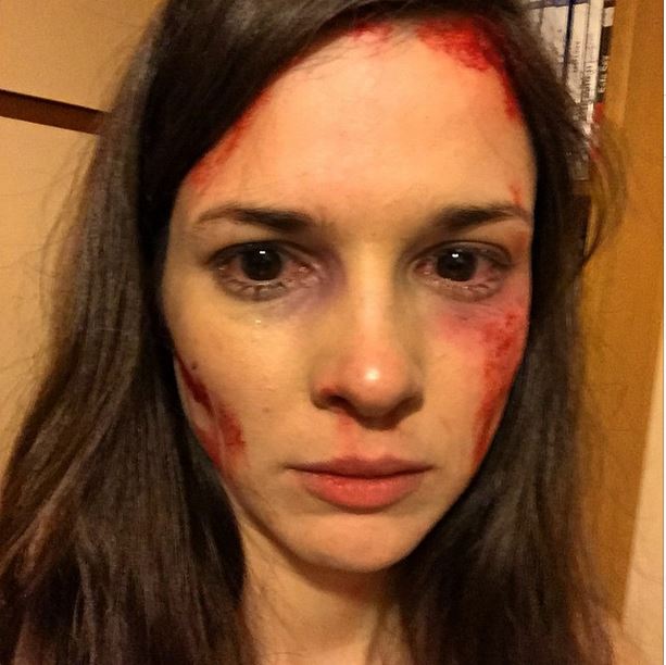 Τι συνέβη στην Ευγενία Δημητροπούλου; – ΦΩΤΟ