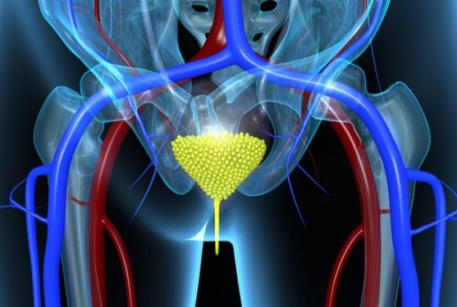 Αντιμετώπιση των ουρολοιμώξεων με φυσικό τρόπο