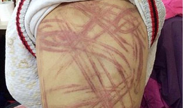 Μαστίγωσε τον θετό γιο της για τον… Πινόκιο – ΦΩΤΟ