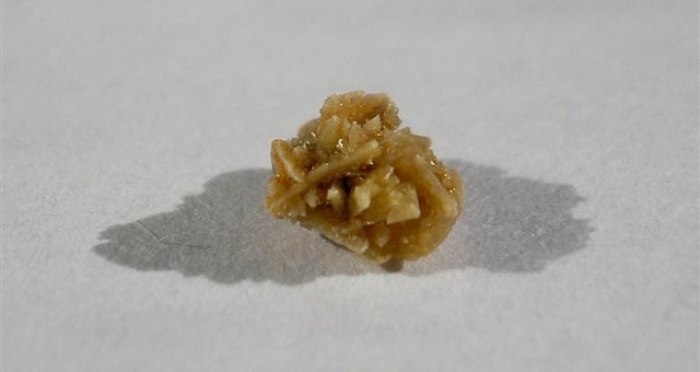 Αντιμετωπίστε με φυσικούς τρόπους τις πέτρες στα νεφρά