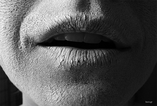 Αφυδάτωση: Τα μηνύματα που στέλνει το σώμα μας